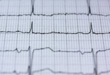 digital fusion node 2049872041